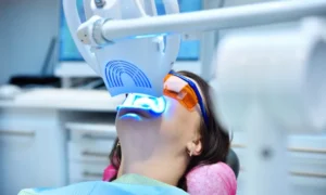 The Complete Guide to Teeth Whitening in Metairie, LA
